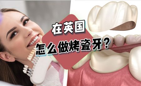 在英国怎么做牙冠（烤瓷牙、全瓷牙、牙贴片）？
