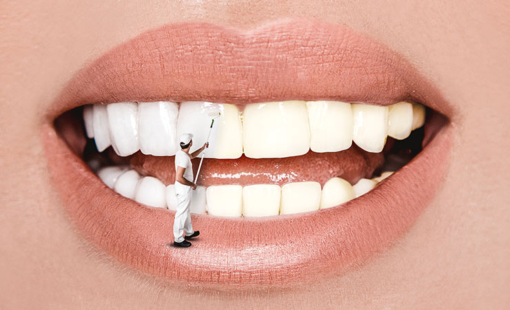 牙齿怎么变白 | 英国牙齿美白产品和牙科项目推荐